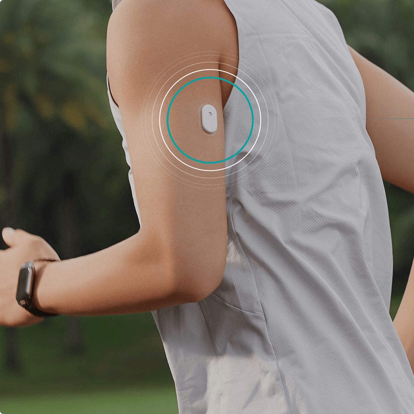 The Sibionics GS3 sensor worn on the back of an upper arm
